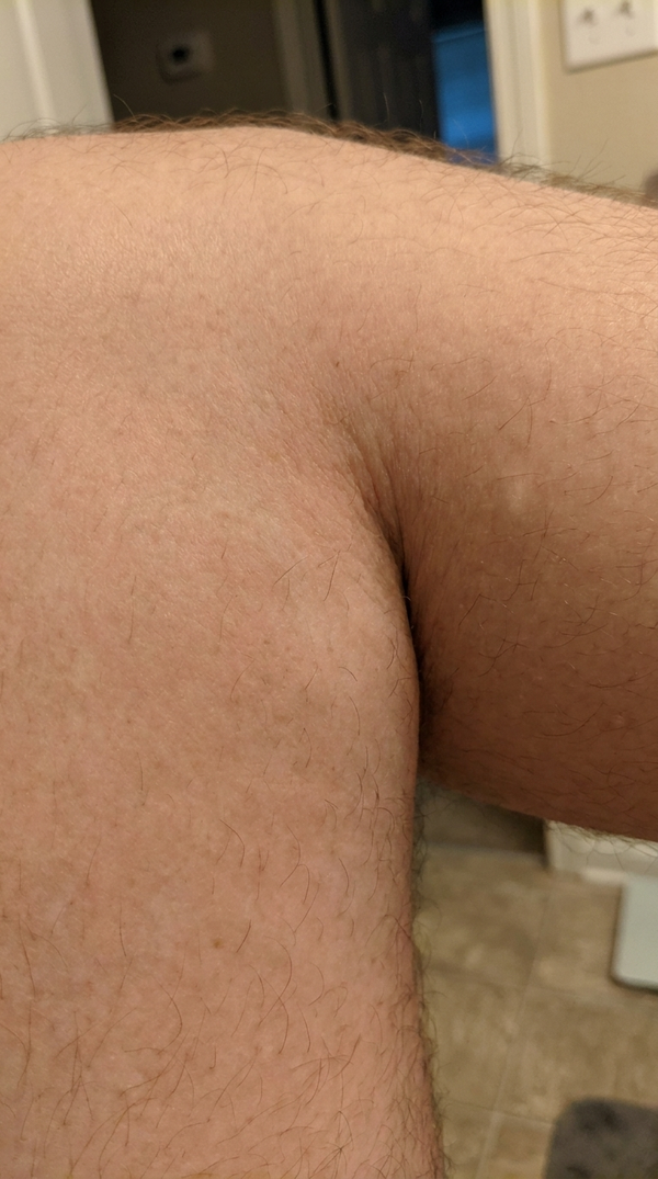 Na